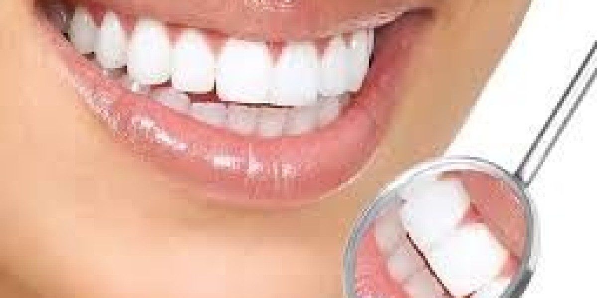 Transform Your Smile with Cosmetic Dentistry in Lake Mary