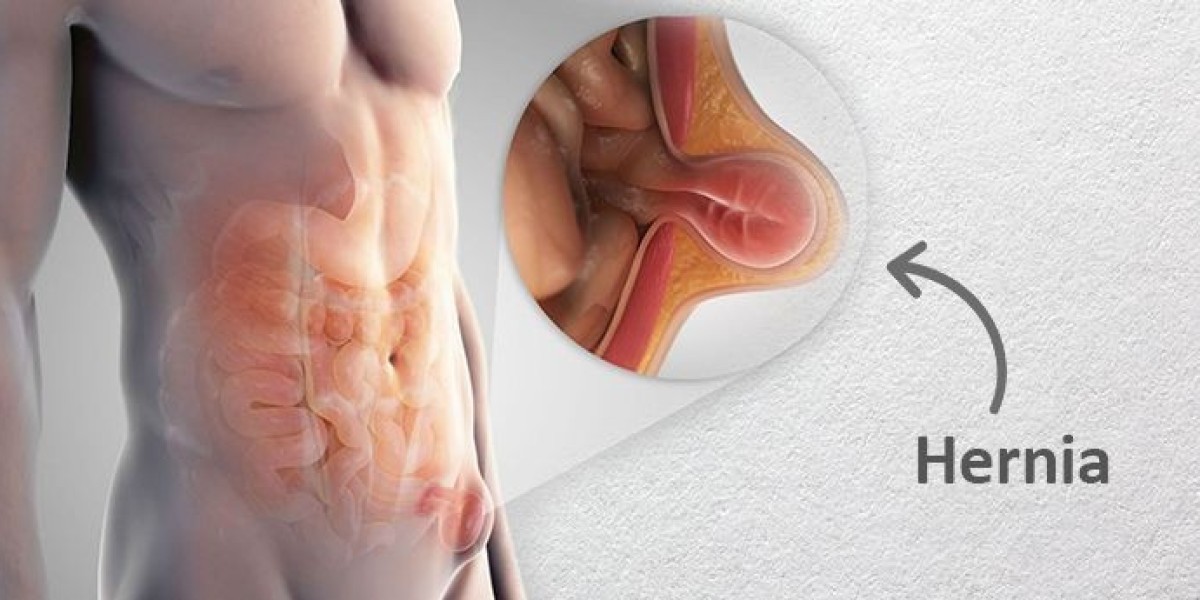 Top Best Doctors for Hernia Surgery in Guwahati: Trusted Specialists with Proven Success | GI Surgery